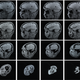 Image for article titled How We Figured Out the Speed of Thought
